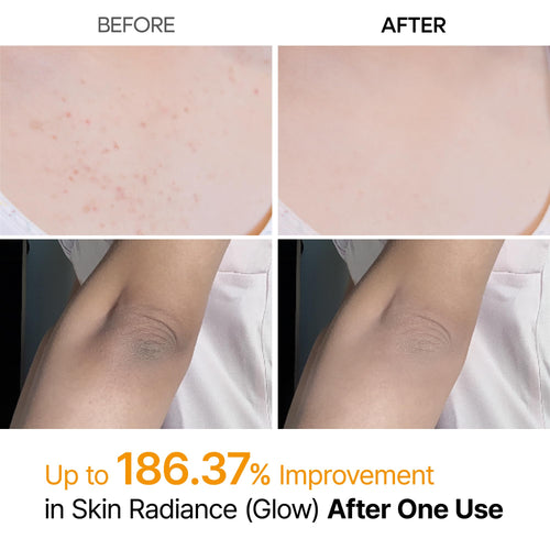 Grabello™ Kojic Acid & Turmeric De-Tan Body Glow Spray For Face, Neck, Hands, Legs, Back,Bumps and Inner Thighs | Buy 1 Get 1 Free