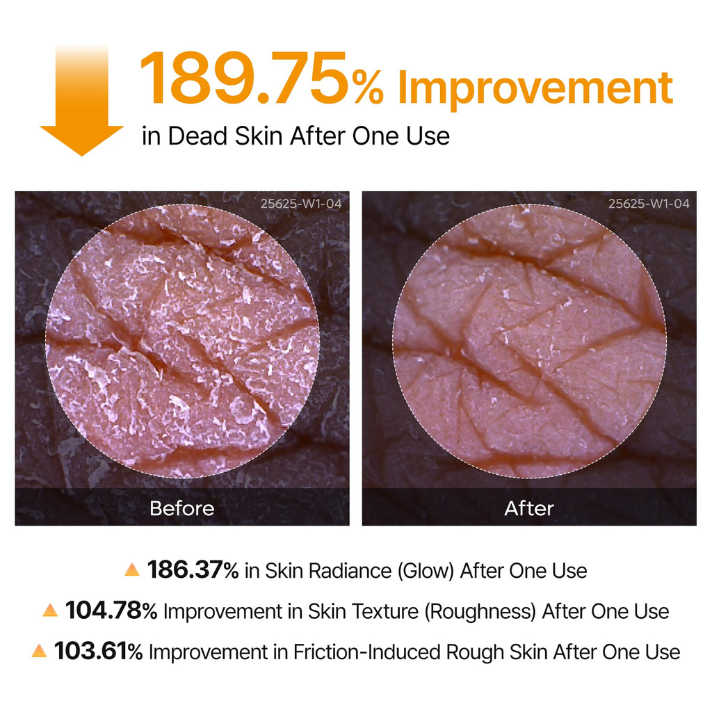 Grabello™ Kojic Acid & Turmeric De-Tan Body Glow Spray For Face, Neck, Hands, Legs, Back,Bumps and Inner Thighs | Buy 1 Get 1 Free