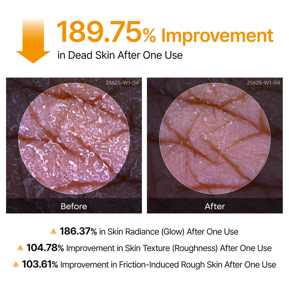 Grabello™ Kojic Acid & Turmeric De-Tan Body Glow Spray For Face, Neck, Hands, Legs, Back,Bumps and Inner Thighs | Buy 1 Get 1 Free